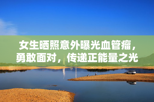 女生晒照意外曝光血管瘤，勇敢面对，传递正能量之光